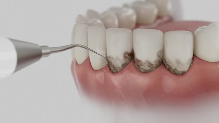 Reliable Root Canal Treatment contractor in Duchesne County County, UT by Dentist Open Now